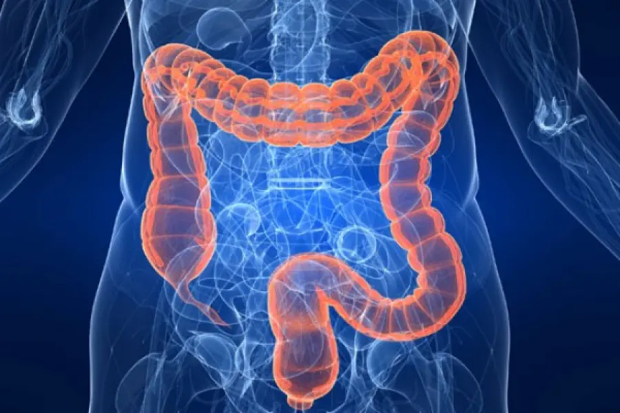Tumore al colon, quando l’alimentazione è la prima prevenzione