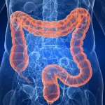 Tumore al colon, quando l’alimentazione è la prima prevenzione